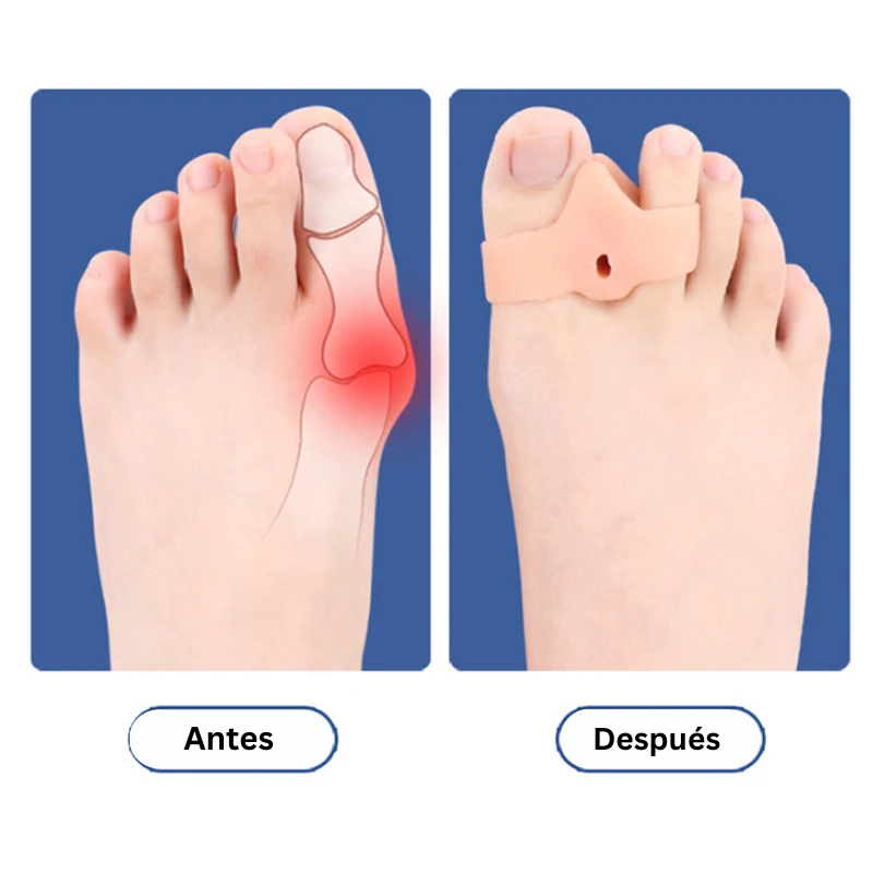 Separador de Silicona para Dedos de los Pies Corrector de Juanetes (1 Par)