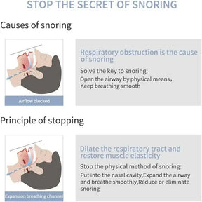 Mini Silicone Stop Snoring Device Breathing Protection Tool Hollowed Out Enlarged Nostril Anti Snoring Nasal Congestion